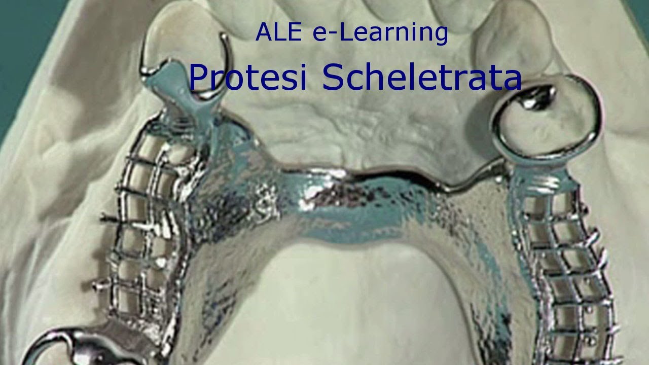 ALE e-Learning - 03 - Protesi Scheletrata