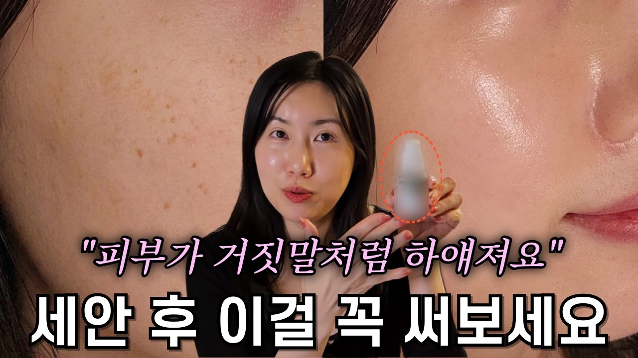 기미, 색소침착 99% 사라집니다. 비싼 돈 쓰지 마세요! ㅣ직접 미백 효과 본 나이아신아마이드 꿀조합