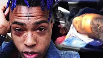 COMMENT XXXTENTACION EST DECEDE ? (ses dernières heures...)