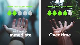 How to Stop Sweaty Hands | SweatBlock Antiperspirant Lotion Profile