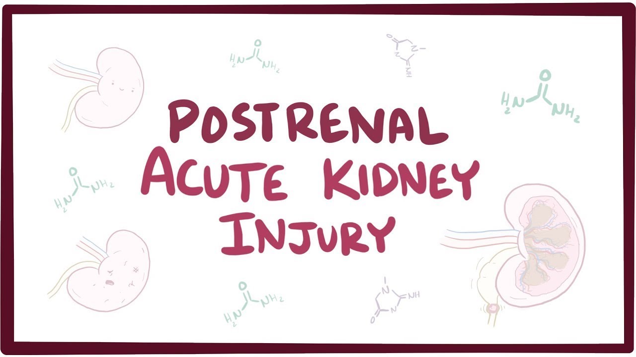 Postrenal Acute Kidney Injury Acute Renal Failure An Osmosis Preview Youtube
