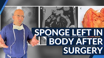 Sponge Left In Body Following Surgery