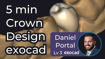 5 Min Crown Design for Dentists in exocad - ep#0001