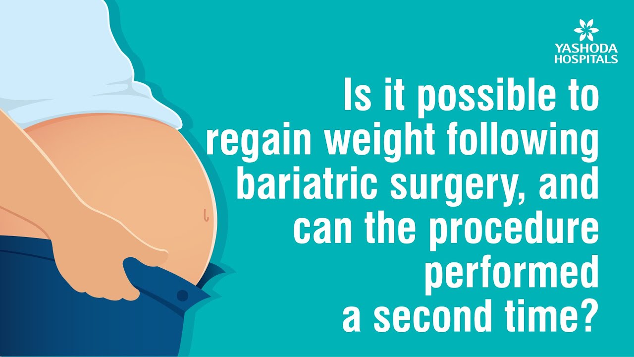 Is it possible to regain weight after bariatric surgery? - YouTube