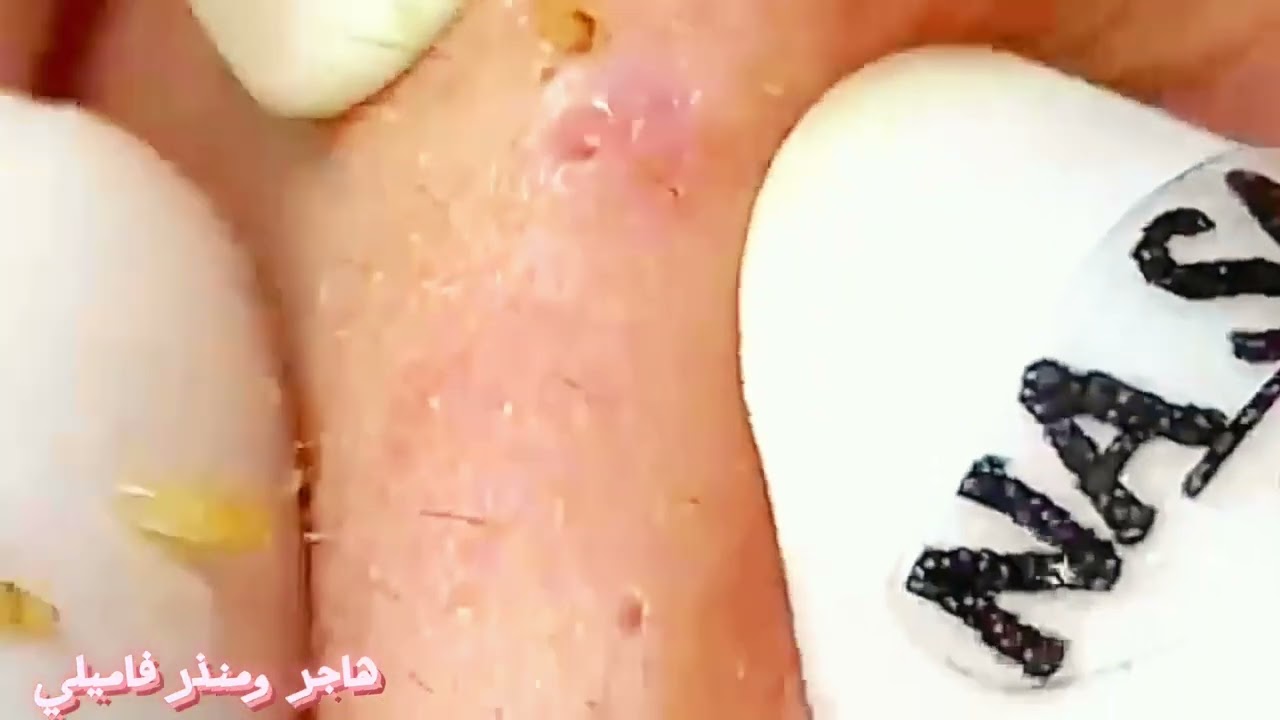 مستقيل بدمع العين أمضى/luxury Great work from most brofessional doctor 🥰