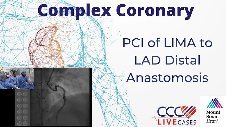 PCI of LIMA to LAD Distal Anastomosis - CCC Live April 2014