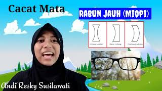 Alat Optik (Mata)