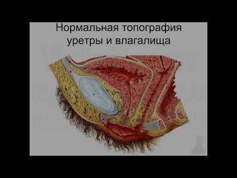 Мочеполовая система для остеопатов 2022 07 01 11 52 33