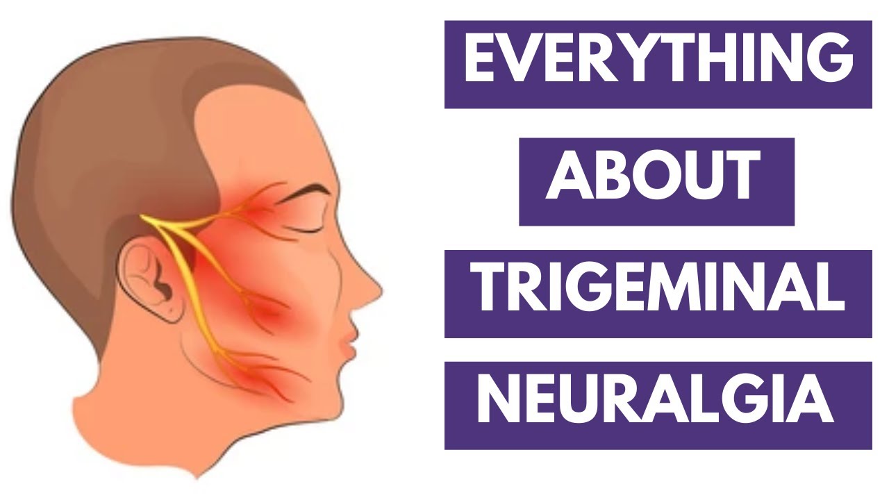 Trigeminal Neuralgia Introduction Clinical Features Diagnosis Trigeminal neuralgia introduction clinical features diagnosis