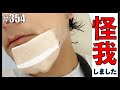 【報告、怪我しました】結構ヤバそうな感じに怪我したので報告します。　エンガブ #354【オネエ】
