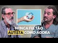 LOBÃO FALA SOBRE DIAGNÓSTICO DE AUTISMO