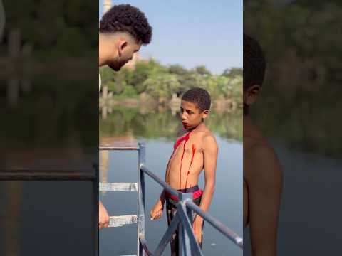 حرام عليك الواد نزل دم من منخيرو   فنتستا اكسبلور ضحك