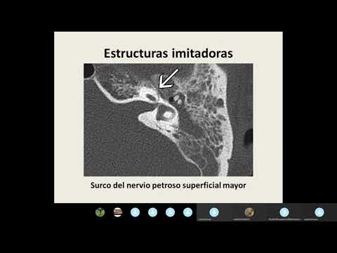 Video: Fracturas óseas En Chinchillas