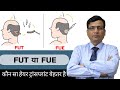 FUT or FUE  - Which Is Better For Hair Transplant |Indore| Dr. Anil Garg - Hair Restoration Surgeon