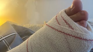 Ben Came Off His Bike 