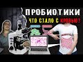 Пробиотики: что стало с кровью под микроскопом?