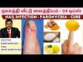     nail skin infection home remedies paronychia dr karthikeyan