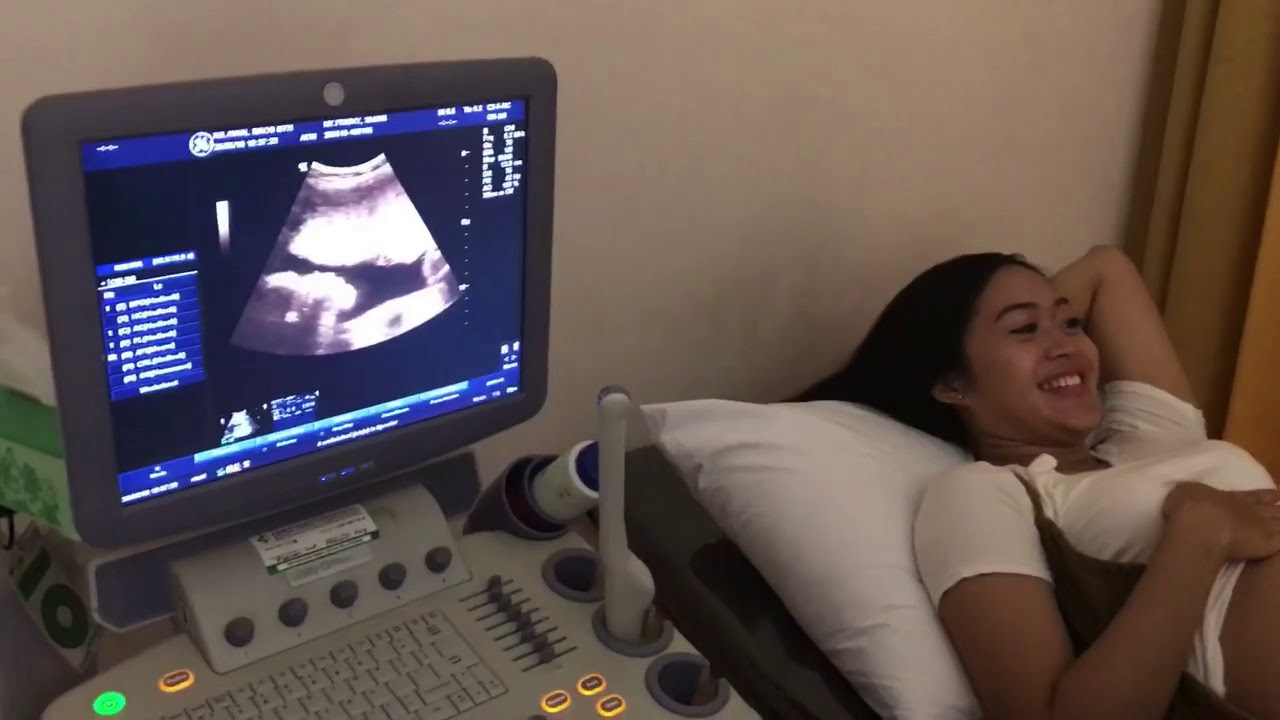 USG 3 DIMENSI KEHAMILAN 6 BULAN 2 MINGGU - CALON BAYI SEMAKIN SEHAT