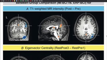 Immediate brain plasticity after one hour of BCI (Nierhaus et al. 2019)