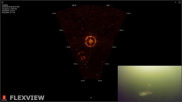 Flexview HF   Moon Jellyfish