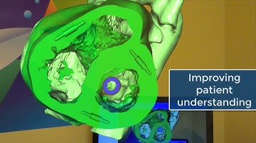 RadHA Augmented Reality app March 2018 Compilation