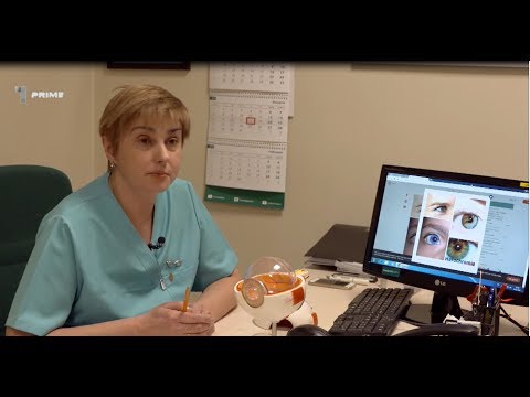 Video: Heterocromia Irisului - Glosar De Termeni Medicali
