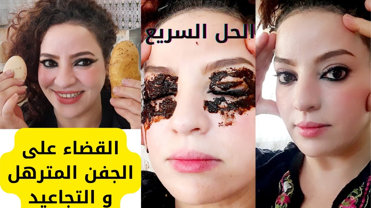 الحل السريع لشد منطقة حول العين و رفعها+ شد ترهل الجفون بدون جراحة ولا تكاليف🤑 face exercises