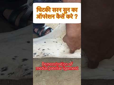 Demonstration of MPD