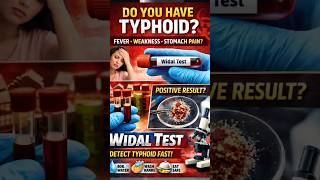 widal  test se pata chal sakta hai Typhoid  High fever ho raha hai? Shayad Typhoid ho sakta h