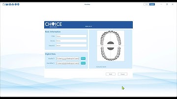 AI-1  Project Creation with Auto Teeth Segmentation