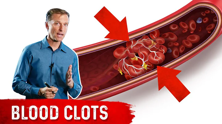 How to Know if You Have a Blood Clot - DayDayNews