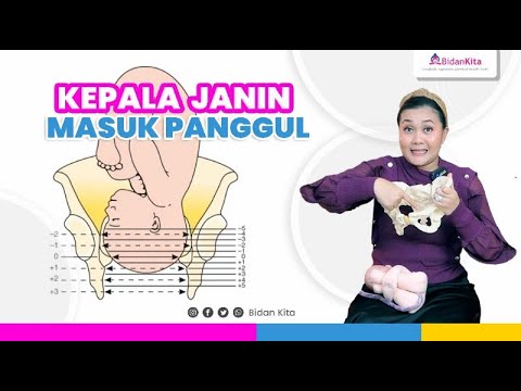 STRATEGI agar KEPALA JANIN MASUK PANGGUL - YouTube