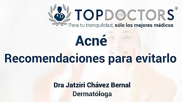 ¿Cuáles son los 3 consejos para prevenir el acné?