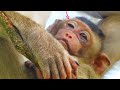 Oh God Bless Pity Baby SADA Has Swelling Face By Difficult To Open His Eye And Drinking Milk Oh God Bless Pity Baby SADA Has Swelling Face By Difficult To Open His Eye And Drinking Milk