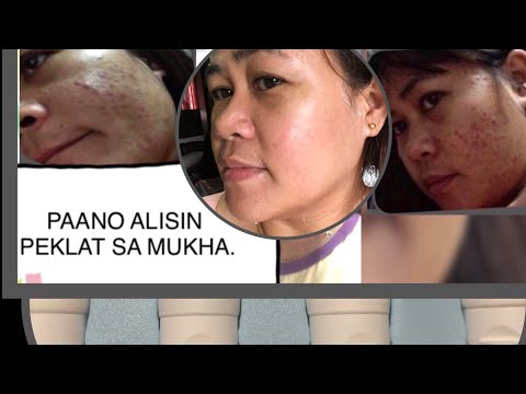 Paano Mawala Ang Peklat Sa Mukha - angbisaga