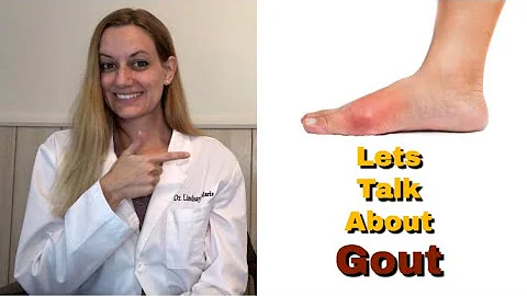 GOUT: Everything You Need To Know! Foods That Cause It. Symptoms. Diagnosis. Treatment. Prevention.