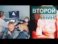 ВТОРОЙ СКРИНИНГ БЕРЕМЕННОСТИ | КАК Я СПРАВЛЯЮСЬ С ДВУХЛЕТНИМ РЕБЕНКОМ | ИМЯ БУДУЩЕГО МАЛЫША