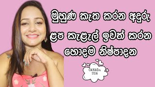 ලප කැලැල් ඉවත්කිරිම සදහා හොදම නිශ්පාදන dark spot remove