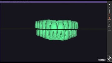 EXOCAD ARTICULATOR CLOSE