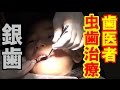 歯医者さんへ！【虫歯治療】銀歯入れた！(2017.01.11) 【栢野紗奈】岡山県よりYoutube配信