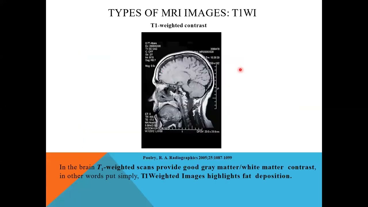 how to read MRI prof.Mohamed Hamdy