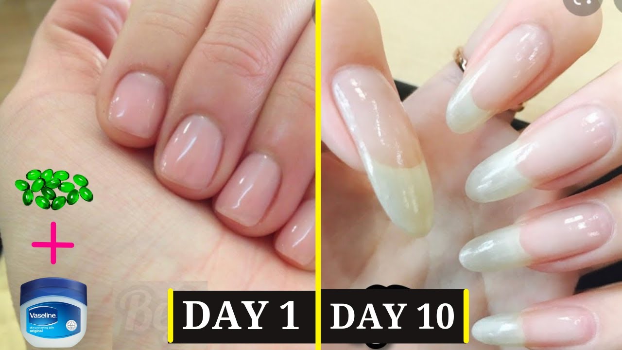 How To Grow Your Nails Really Fast And Long In Just 10 Days Secret