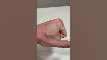 RFID/NFC & Magnetic Implant.(Tiktok @robot_scott )#Shorts