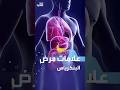 علامات مرض البنكرياس