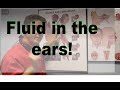 Middle Ear Fluid