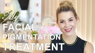 FACIAL PIGMENTATION BE GONE: Picosure Review