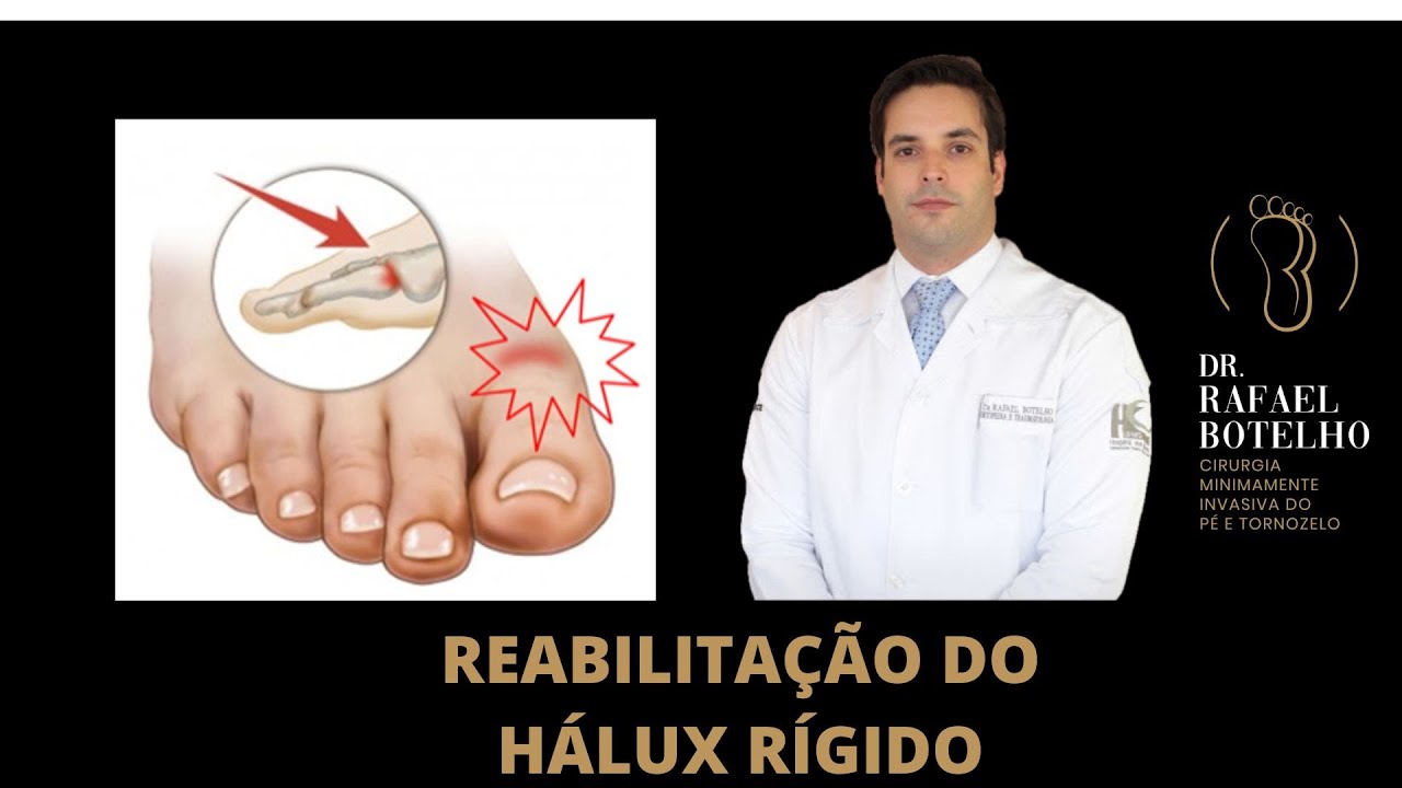 REABILITAÇÃO DO HÁLUX RÍGIDO