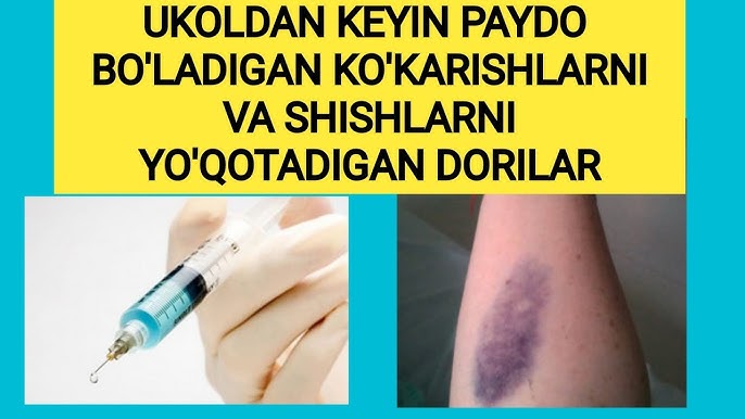 Jinsiy aloqada bolgan etuk, ortiqcha vaznli rus ayollarining fotosuratlari Koptoklar bilan yutib yuboring