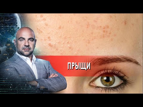 Прыщи. "Как устроен мир" с Тимофеем Баженовым. (29.09.2021)