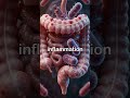 🍞️ Carbs, Sugar, and Gastritis: Keto Connection